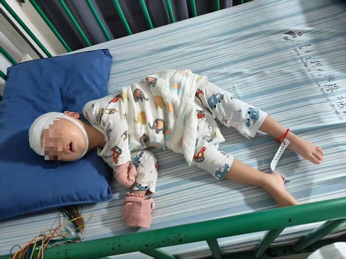 Victim of domestic violence causing cerebral palsy Huang Ze Yue