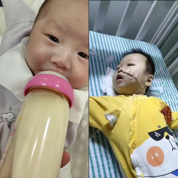 Child's condition before and after injury